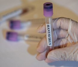 Hantavirüs enfeksiyonu erken dönemde grip ile karıştırılabiliyor