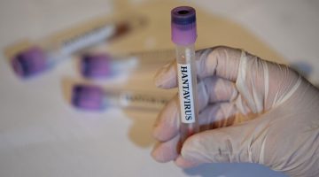 Hantavirüs enfeksiyonu erken dönemde grip ile karıştırılabiliyor