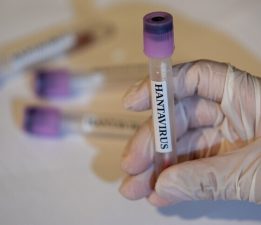 İngiltere, bir İngiliz vatandaşında daha hantavirüs şüphesi tespit edildiğini açıkladı
